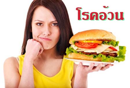 โรคอ้วน อ้วน วิธีลดน้ำหนัก สุขภาพ